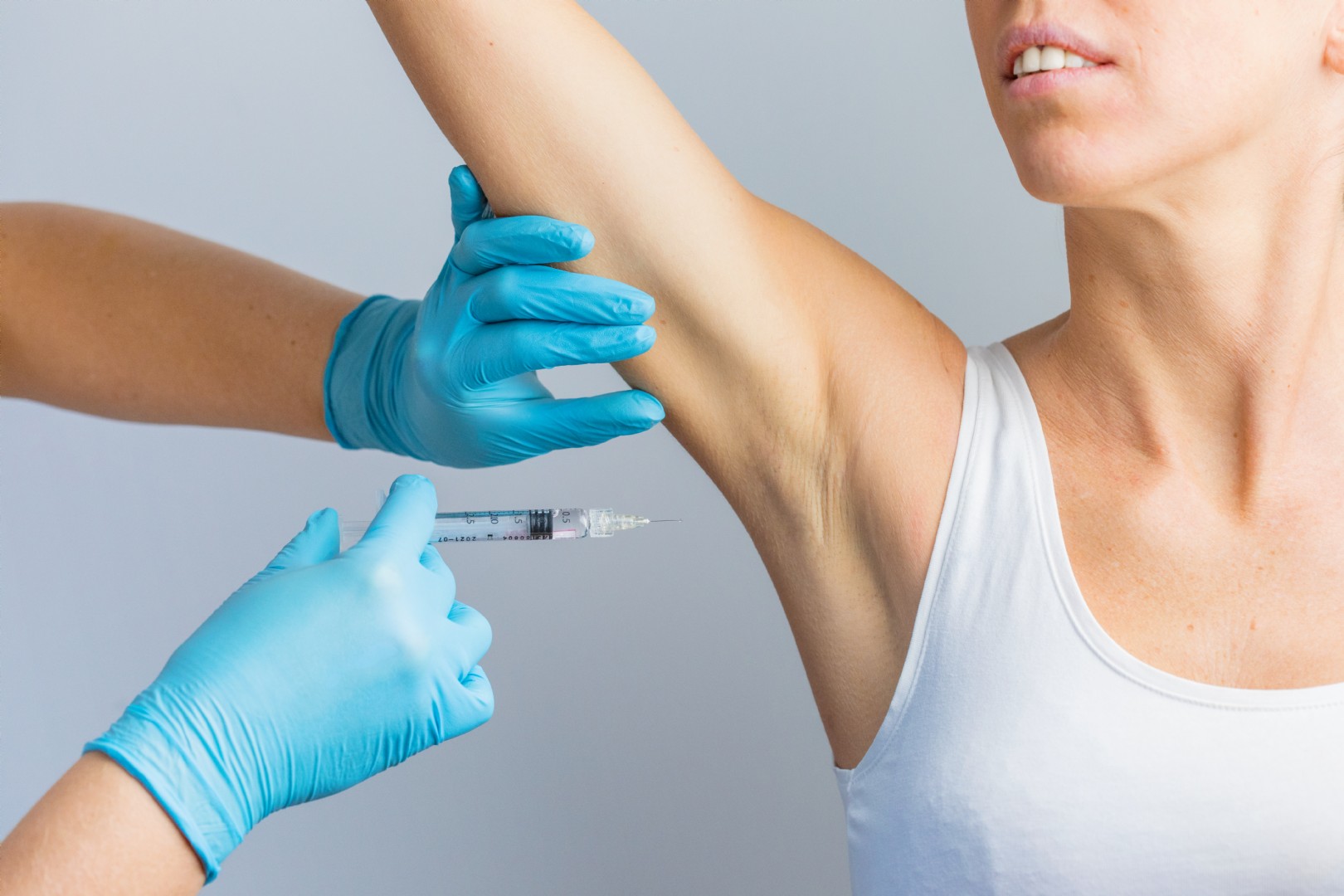 Armpit (Hyperhydrosis) Botox